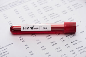 Read more about the article Como Lidar com um Diagnóstico Recente de HIV